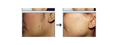 Immagine 1 azienda LA FENICE SPA Servizi di bellezza in Ciampino RM