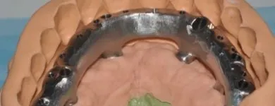 Immagine 3 azienda LORD SAS LABORATORIO ODONTOTECNICO Salute in Milano