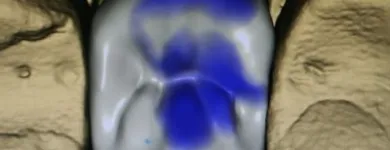 Immagine 4 azienda LORD SAS LABORATORIO ODONTOTECNICO Salute in Milano