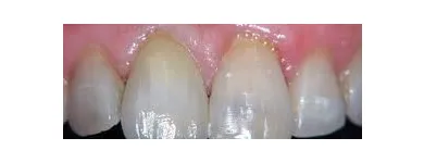 Immagine 5 azienda LORD SAS LABORATORIO ODONTOTECNICO Salute in Milano