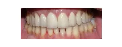 Immagine 6 azienda LORD SAS LABORATORIO ODONTOTECNICO Salute in Milano