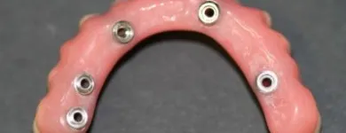 Immagine 7 azienda LORD SAS LABORATORIO ODONTOTECNICO Salute in Milano