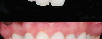 Immagine 1 azienda STUDIO ASSOCIATO VISCA MEDICI DENTISTI Salute in Latina