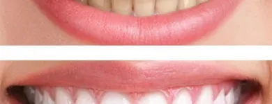 Immagine 2 azienda STUDIO ASSOCIATO VISCA MEDICI DENTISTI Salute in Latina