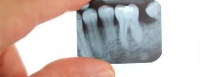 Immagine 1 azienda STUDIO DENTISTICO CAVALLINI Salute in Pisa
