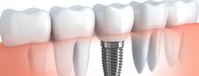 Immagine 3 azienda STUDIO DENTISTICO CAVALLINI Salute in Pisa