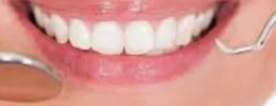 Immagine 5 azienda STUDIO DENTISTICO DR. ALESSIO NIZZI Salute in Pisa