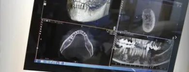 Immagine 3 azienda STUDIO DENTISTICO DR. CONSALVO MICHELE Salute in Borgosatollo BS