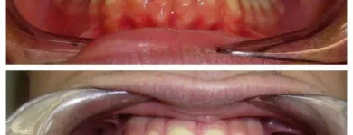 Immagine 6 azienda STUDIO DENTISTICO VOLPE Salute in Salerno