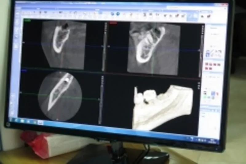 Immagine 1 azienda TERAMED CENTRO MEDICO DENTISTICO