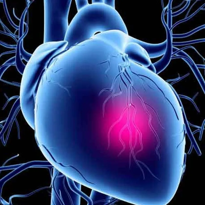 Immagine 6 azienda CENTRO CARDIOLOGICO VESUVIANO